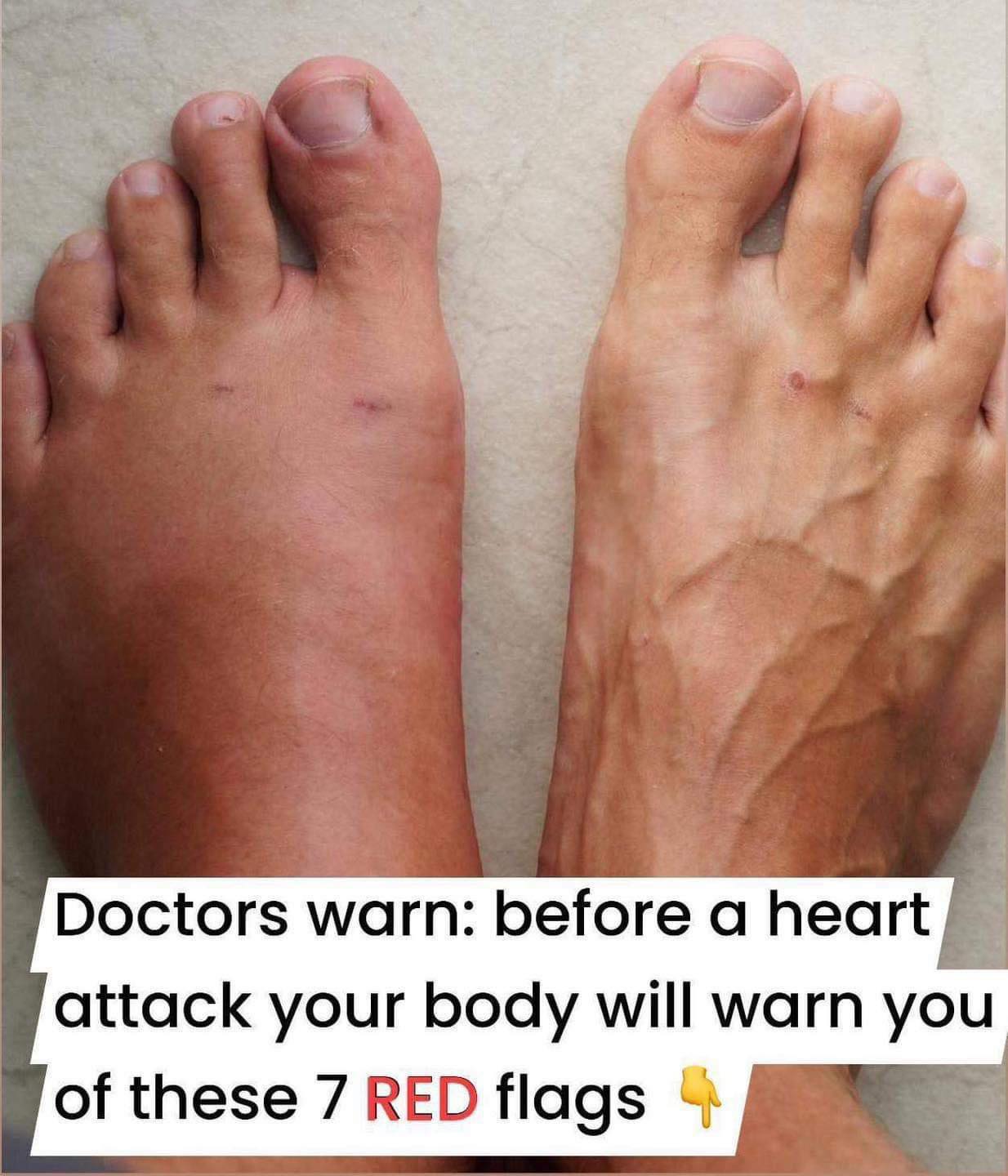 A month before a heart attack, your body will warn you of these 7 signs